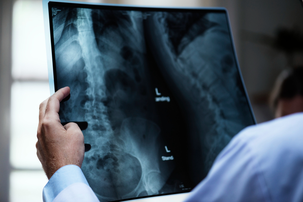 A New Beginning After Spine Surgery